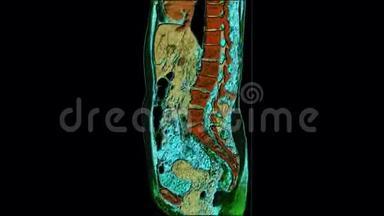 腹腔、<strong>胃肠</strong>道、膀胱的彩色对比MRI