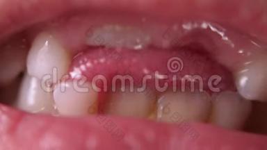 宝宝牙齿宏拍.. 无牙的微笑。 一颗摇摇晃晃的牙齿。 切根牙。 舌头在牙齿之间的洞里。