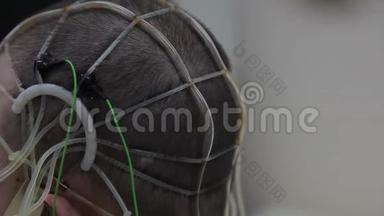 医生把电子传感器连接到病人`头上。 进步医疗技术。 纳米技术4K