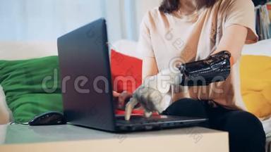 一位手持仿生手的女士正在她的笔记本电脑上打字