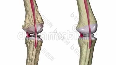 骨关节炎：膝关节伴<strong>韧带</strong>和软骨
