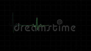 心电图上心跳频率的3D动画。 医疗保健。