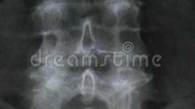 人体脊椎骨和骨盆的X线片