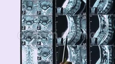 女医生指着病人向<strong>实习生</strong>讲述疾病的脊柱核磁共振