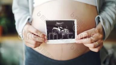 大腹便便的特写镜头和<strong>妇女</strong>`双手握着<strong>健康</strong>未出生婴儿的超声波图像。 怀孕、<strong>妇女</strong>`
