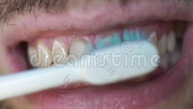一群白人用电动牙刷刷牙. 人`刷牙时张开嘴。