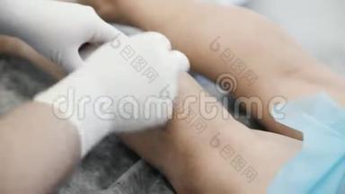 静脉曲张患者在硬化治疗前的腿部消毒手套中的静脉医生特写双手