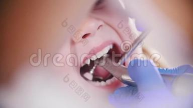 牙医。 女牙医慢动作抛光小<strong>宝宝牙齿</strong>