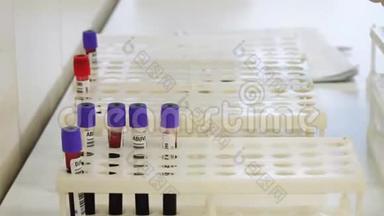 医生的特写`他的手戴着橡胶手套，在实验室里用血液试管工作。 框架。 医学和医学