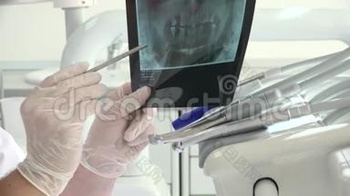 手持牙科X线摄影，牙科医疗工具