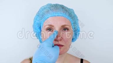 鼻成形术：接受整形外科手术的病人。 她必须要通过鼻子