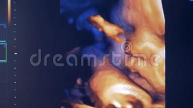 超声监视器上<strong>胎儿</strong>的实时图像。<strong>胎儿</strong>在子宫里的真实形象。