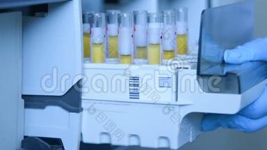 实验室的科学家把装有血液或尿液的试管放在热分析仪的容器里