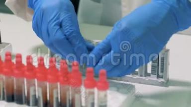 实验室工作人员正在检查带有血液的试管，并将它们放入调色板