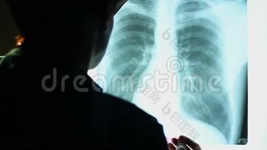 医生检查人胸部X线图像，扫描<strong>肺部</strong>