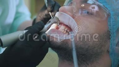 医生和病人在牙科办公室使用唇部<strong>扩张</strong>器，用口腔刷子进行抛光