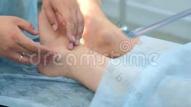 外科医生在手术前触诊腿部，以去除关节中的<strong>脚踝</strong>湿瘤，特写。