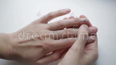 病钉上的瘀伤.. 职业创伤。 不健康受损手指指甲.. 女孩检查指甲异常