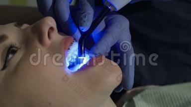 牙医`他的医生治疗他病人的牙齿。 牙医把一个光聚合物<strong>封口</strong>