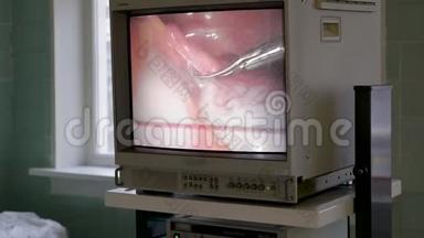 视频操作，在监视器上广播.. 医生用特殊的机械手工作。