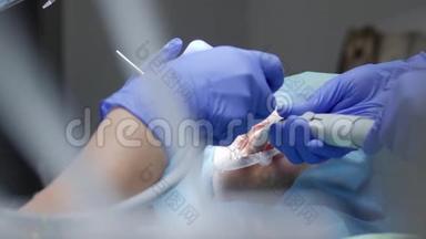 <strong>医学研究</strong>，戴橡胶无菌手套的医生，借助特殊的牙科器械清洗病人的牙齿