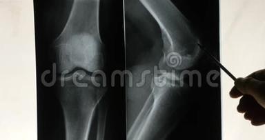 医生研究手臂、腿部关节X线片进行分析。医疗卫生医院。