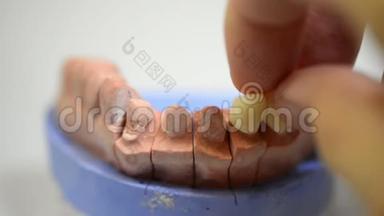 牙科技师，为<strong>种植牙</strong>提供3D打印模具