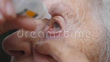 老妇人眼睛里滴着医疗滴。 祖母的肖像。 保健和医疗理念.. 快关门