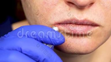 唇部疱疹：一名患感冒和疱疹病毒的妇女接受皮肤科医生和传染病专家的检查