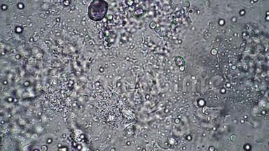 显微镜下牛奶发酵中的<strong>乳酸</strong>杆菌