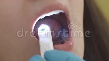 特写，牙医用<strong>口腔</strong>内摄像机检查病人的<strong>口腔</strong>。