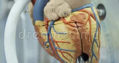 人工血液循环，人`人工心脏，心脏模型。 捐助者之心