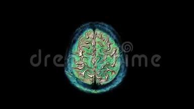 大量的彩色MRI扫描大脑和头部，以检测肿瘤。 诊断医疗工具