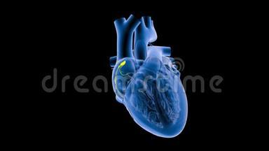 慢动作心脏的SA节点信号或起搏器