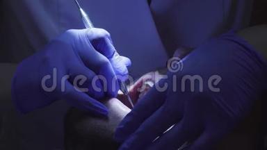 牙医在牙齿上放置复合填充物