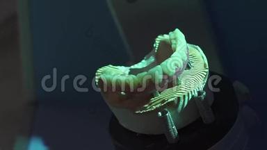 牙科修复。 Denturist正在研制高科技数字扫描雕刻塑料义齿三维模型