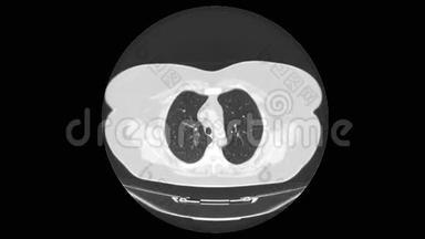肺部和支气管MRI扫描，<strong>呼吸系统</strong>疾病诊断