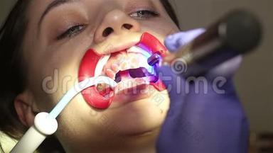 在牙科诊所有<strong>扩张器</strong>的年轻女子。 保护美白凝胶在牙齿上的应用。
