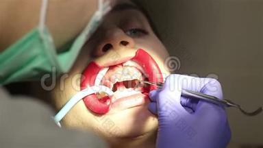 在牙科诊所有<strong>扩张</strong>器的年轻女子。 保护美白凝胶在牙齿上的应用。