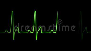 心电图、心电图、心电图、心电图及人体心跳声运动图
