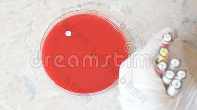 实验室医生或科研人员在培养皿上做抗生物图谱