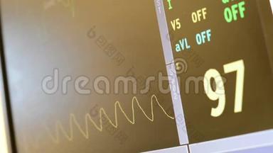 手术室及急诊室的心率监测显示心跳