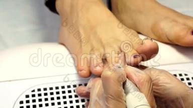内冠脚趾甲的治疗。 你的指甲。 医生是足科医生。 硬件修脚。 儿科。