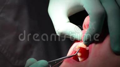 牙医检查牙龈炎的牙龈