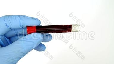 概念血液测试。 双手戴蓝色手套，拿着真血管。