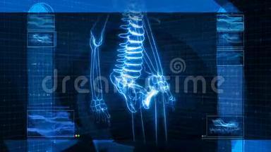 人类骨架X射线(HD)