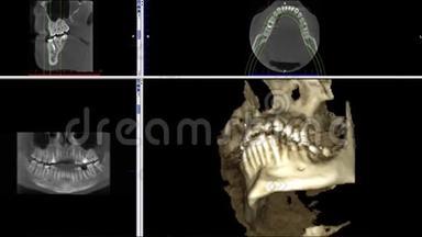 口腔医学、牙科研究、新质量医学、牙科影像动画的人颌骨成像扫描