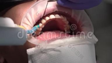 诊所牙科，安装贴面给病人在牙科诊所。 牙医美牙，微笑.. 关门