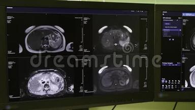 核磁共振扫描的脑部断层扫描。
