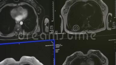 核磁共振扫描专业医疗设备上的脑部断层扫描。